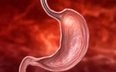 ¿Qué es la Panendoscopia en Bogota?