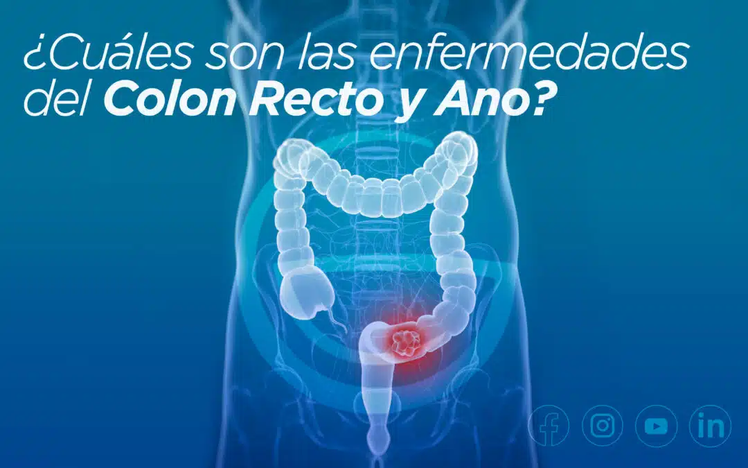 Enfermedades del Colon Recto y Ano