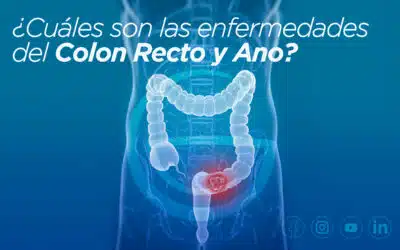Enfermedades del Colon Recto y Ano