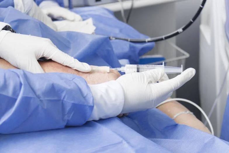 Sedación del paciente para hacer la colonoscopia Procedimiento de colonoscopia con sedación