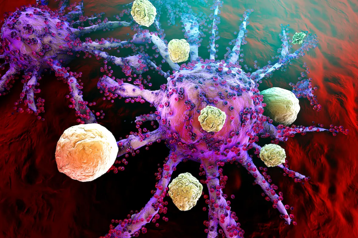 Detecte el cáncer de recto con ultrasonido endoscópico