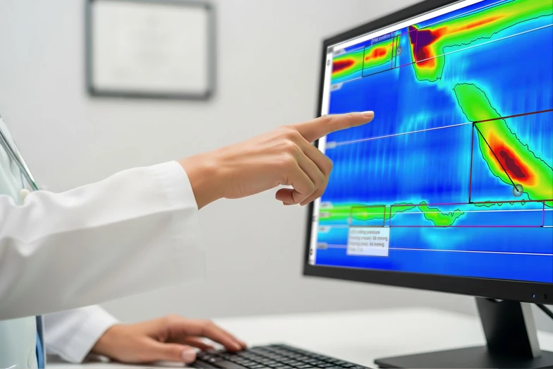 El monitor muestra gráficas del esófago Especialista señalando las alteraciones del esófago